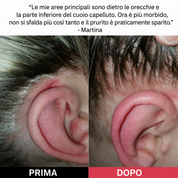 Scrub per il cuoio capelluto