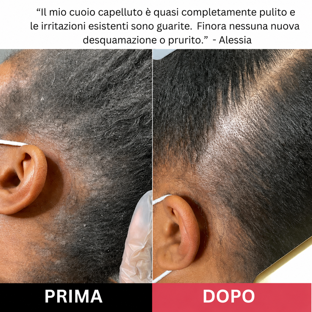 Scrub per il cuoio capelluto