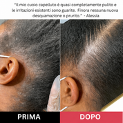 Scrub per il cuoio capelluto
