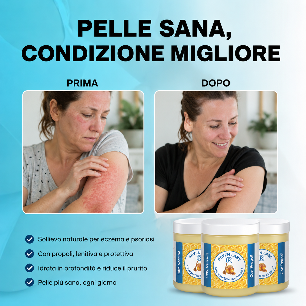 Balsamo riparatore per eczema e psoriasi