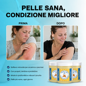 Balsamo riparatore per eczema e psoriasi